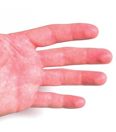 Invisible UV Skin Marker Spray 6 Oz